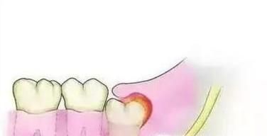 智齿什么时候长