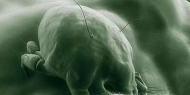 如何去除床上螨虫的办法