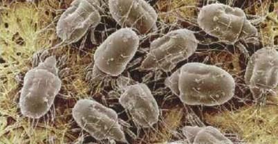 如何去除床上螨虫的办法