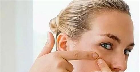 怎么样去黑头最有效