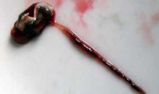 罗氏虾怎样去内脏图解