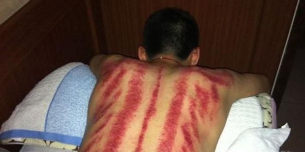 刮痧的好处有哪些