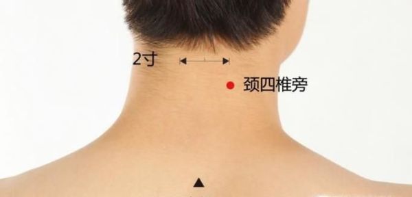 刮痧的好处有哪些