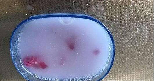 蚊虫叮咬如何防止感染其他疾病？如何快速消肿？