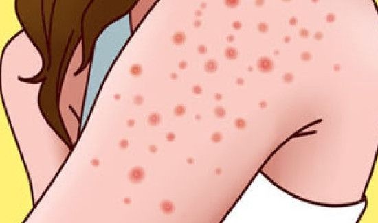 家里甲醛超标人会有什么感觉