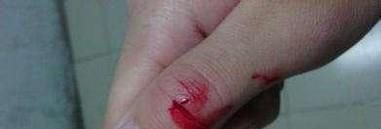 美瞳瓶子怎么打开