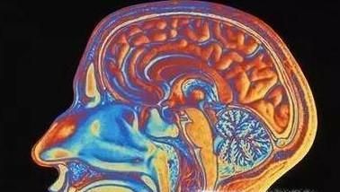 智力残疾鉴定怎么鉴定