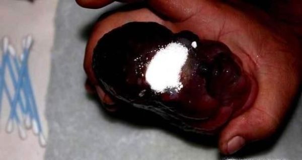 罗汉鱼头洞病治疗方法