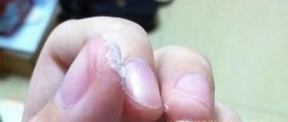 鞋底破损怎样修复