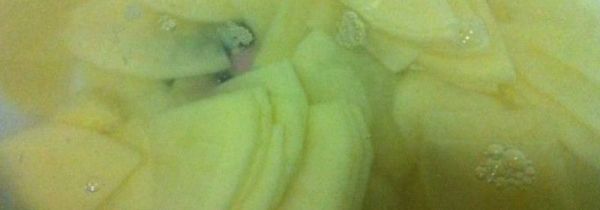 土豆片氧化发黑能吃吗