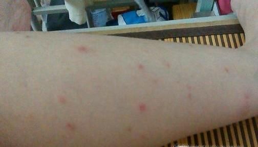 藿香正气水有哪些意想不到的妙用?