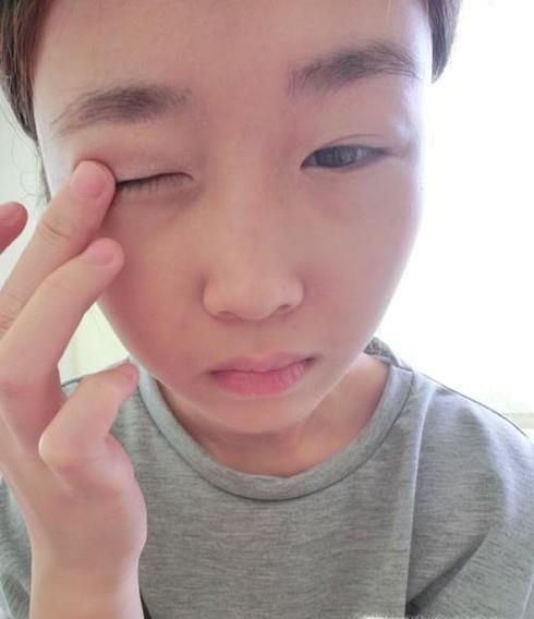 怎么办眼睫毛进眼睛里出不来了