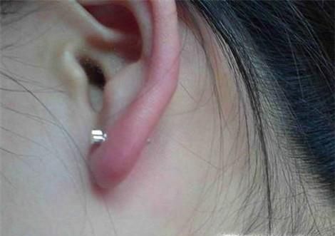 打了耳洞怎么消毒