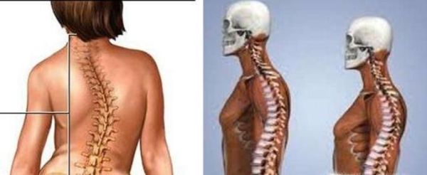 趴桌子上睡觉有危害吗？