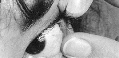 隐形眼镜怎么摘下来