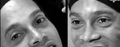 怎样看自己是不是龅牙