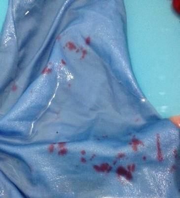 衣服染上了颜色怎么清洗？