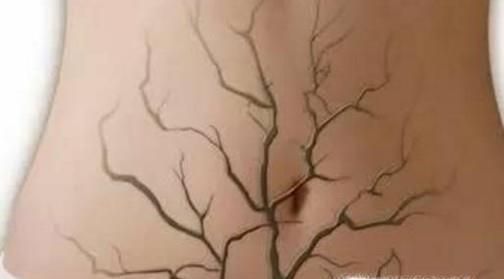 猕猴桃有哪些让人意想不到的功效?