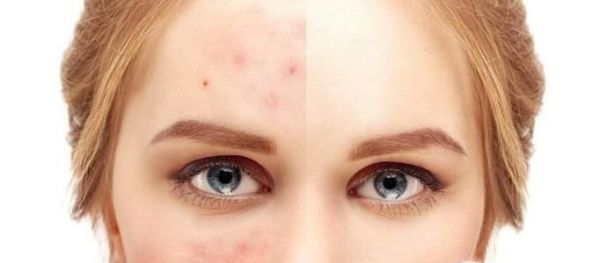 喝蜂蜜柠檬水对人体有什么好处？