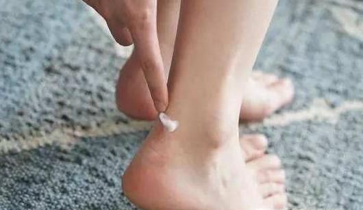 夏季如何健康穿高跟鞋？这样做远离足蜂窝织炎！