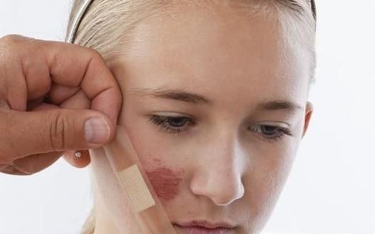 家庭暴力该怎么办