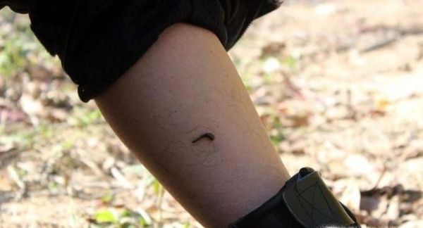 野外活动被蚂蝗叮咬了怎么办