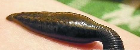 野外活动被蚂蝗叮咬了怎么办