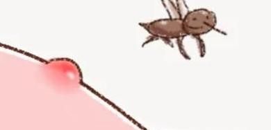 蚊虫叮咬后如何快速止痒