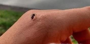 蚊虫叮咬后如何快速止痒