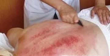 寒湿体质要怎么祛寒