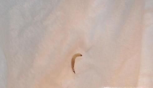 蛾蚋幼虫进入人体怎么办