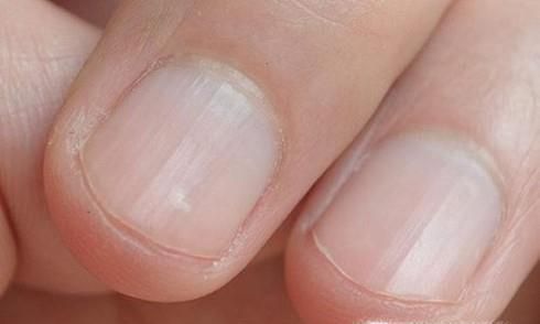 身体亚健康有什么症状？