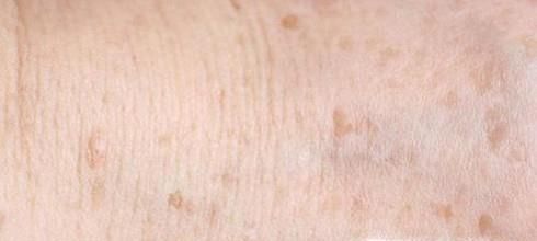 身体亚健康有什么症状？