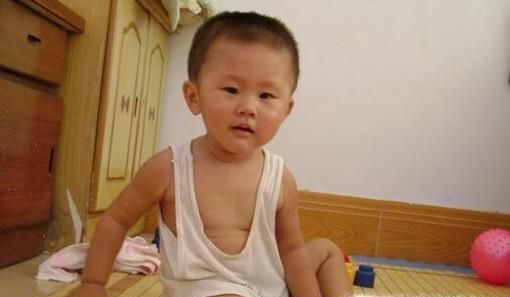 天气这么热, 长了痱子怎么办