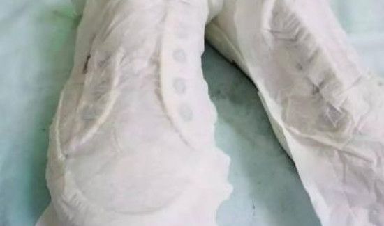 鞋子氧化发黄能清洗回来吗