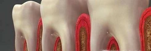 洗牙有什么认识误区？洗牙有什么好处？