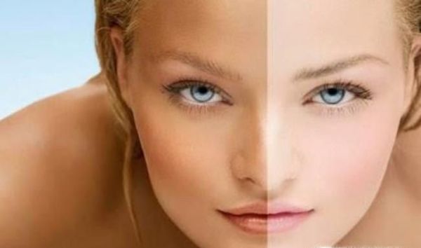 为什么有些人的皮肤晒黑之后不容易变白？