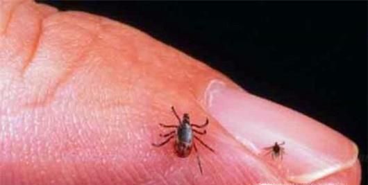 被蜱虫叮咬后怎么办？夏季如何防止被蜱虫叮咬？
