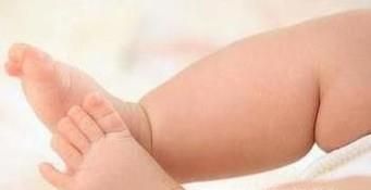 如何改善X腿型，O腿型？