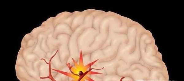 老年嗜睡如何预防？老年嗜睡可能是什么病？