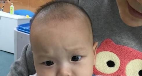 宝宝枕秃是什么原因？枕秃应该如何解决？