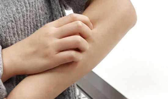 被蚊子咬了可以用酒精消毒吗