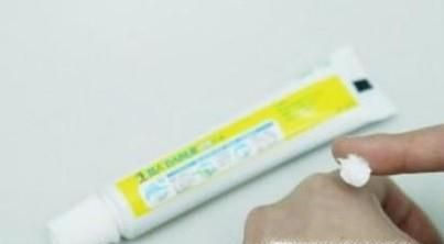 夏天被蚊子咬怎么快速止痒