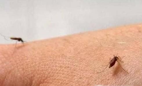 夏天被蚊子咬怎么快速止痒