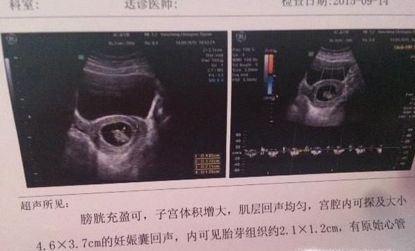 怎么样辨别怀的是男孩还是女孩？