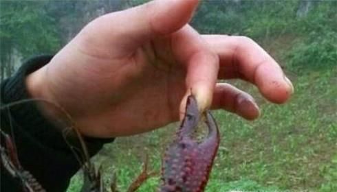 被小龙虾夹到手出血了怎么办