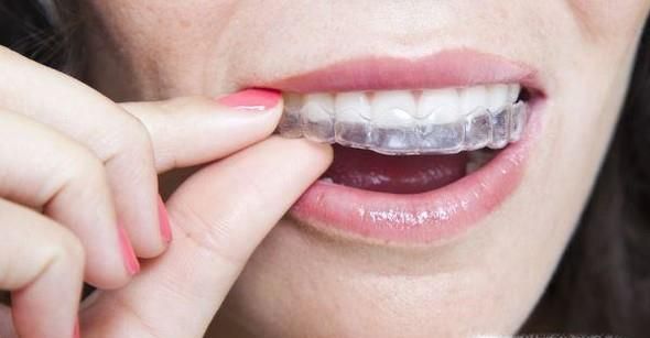 隐形牙套和以往的牙套有什么区别