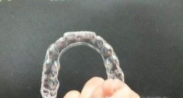 隐形牙套和以往的牙套有什么区别