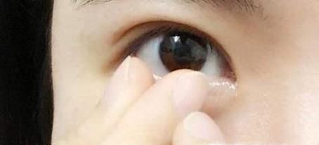 隐形眼镜正确佩戴摘除方法