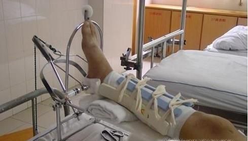 常见的运动损伤与处理